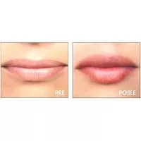 Kliknite za detalje - Perfect Pout SKIN DOCTORS (8ml)