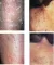 Antiekcem krem sa susamovim uljem 50ml - thumbnail 2