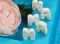 PEBEO Gedeo Mould Alphabet – Numbers – Special Characters - Kalup za livenje SLOVA 30 x 20cm 667029 - thumbnail 2